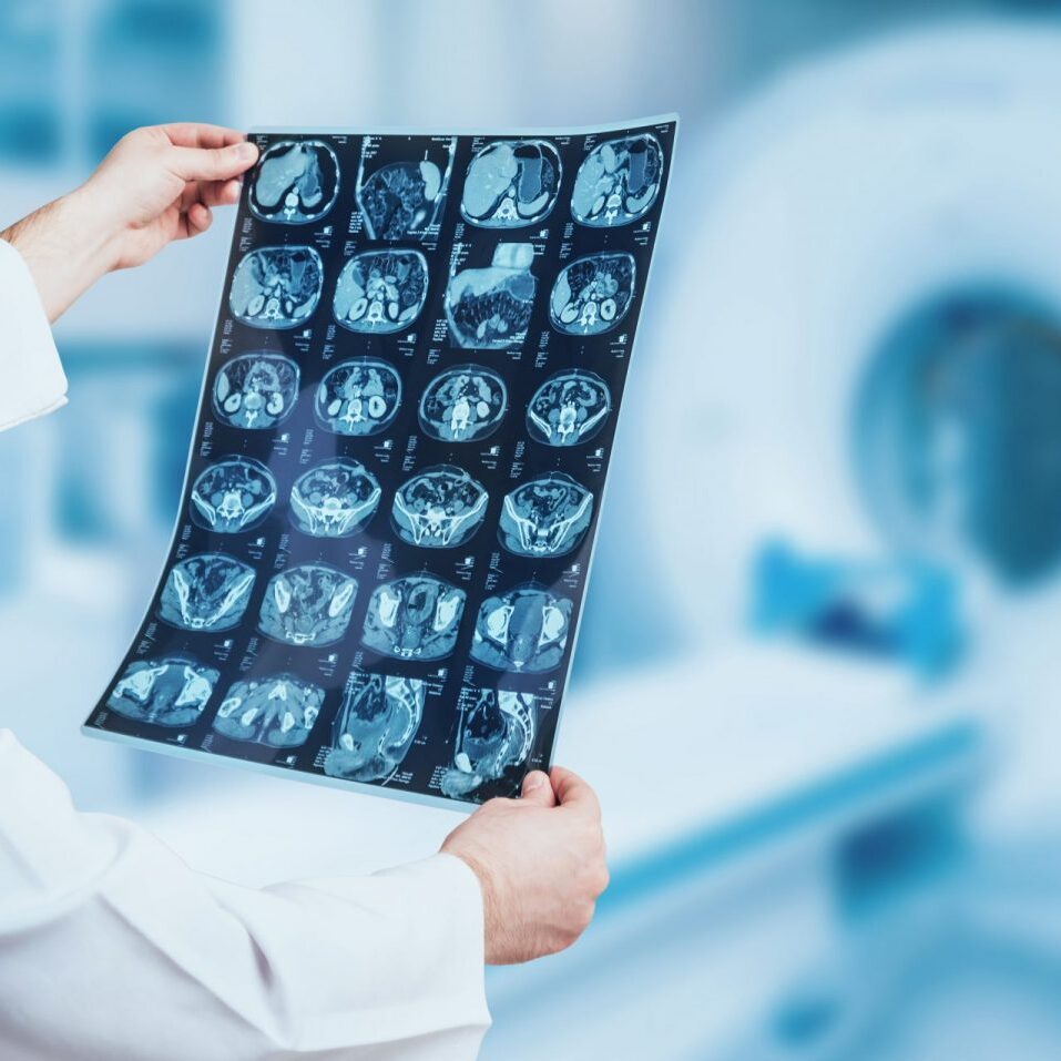 Doctor-looking-MRI-picture -scaled-e1591100669735